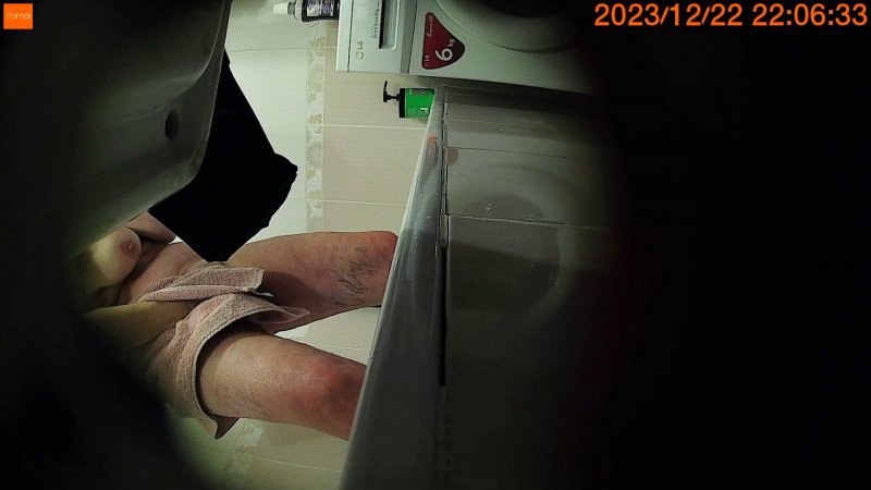 supraglottoplasty with laser laryngomalacia adult with Sassylynn_25 — adult tube video